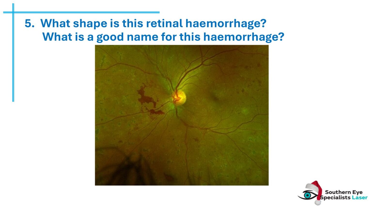 Answering back: Optometrists get smart with us at the SES Xmas quiz night 5 SES optometrists Xmas quiz-3