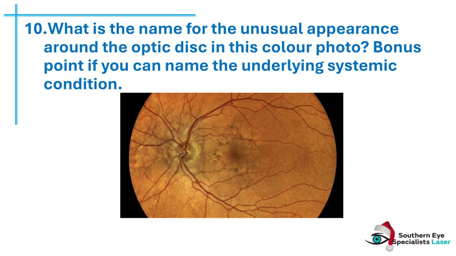 Answering back: Optometrists get smart with us at the SES Xmas quiz night 4 SES optometrists Xmas quiz-4