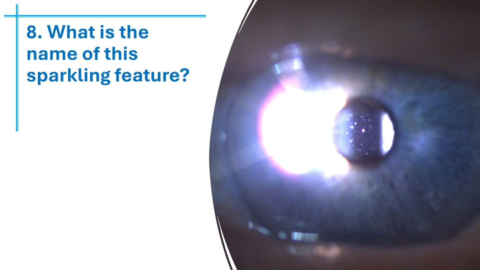 Answering back: Optometrists get smart with us at the SES Xmas quiz night 3 SES optometrists Xmas quiz-5